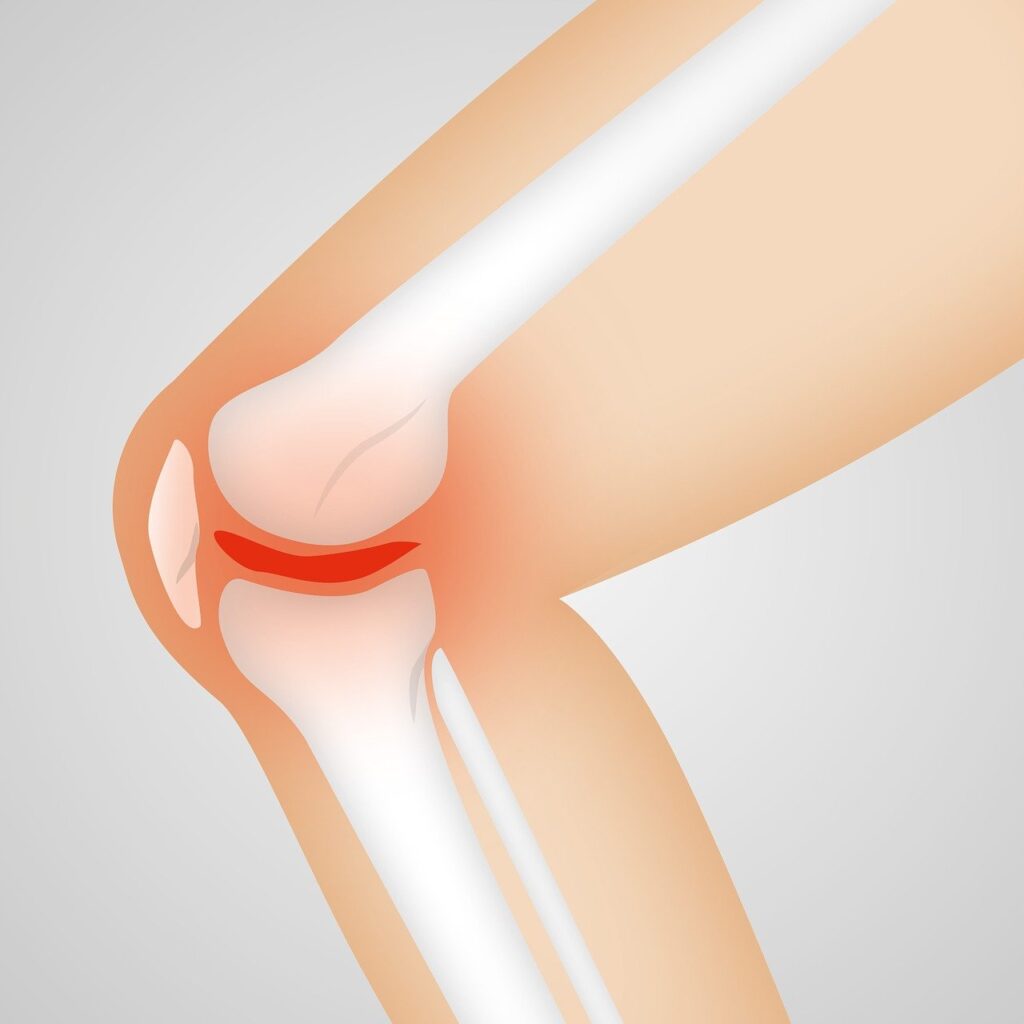 knee and back pain problem